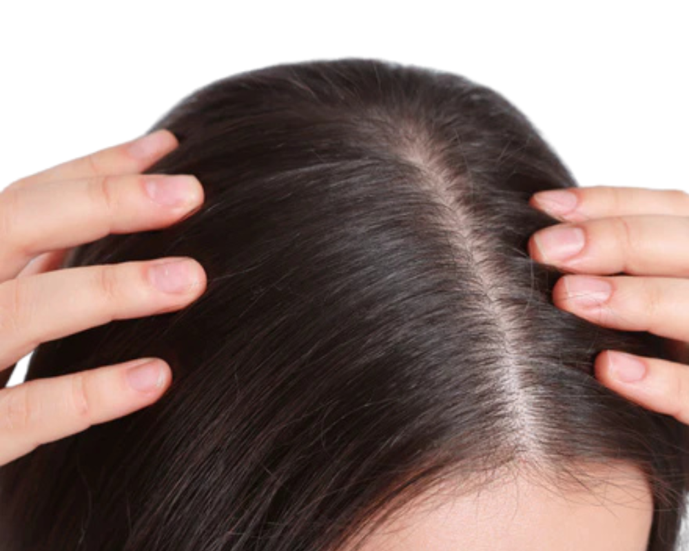 hair scalp stock image (1).png__PID:5fb9461b-e1bf-4468-ba76-002f178f89e6