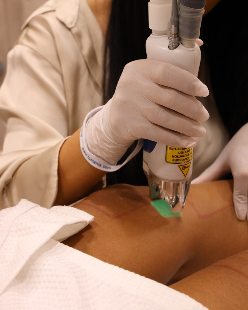 Laser Hair Removal - Cosmetic Wellness Skin Care Clinic Sydney