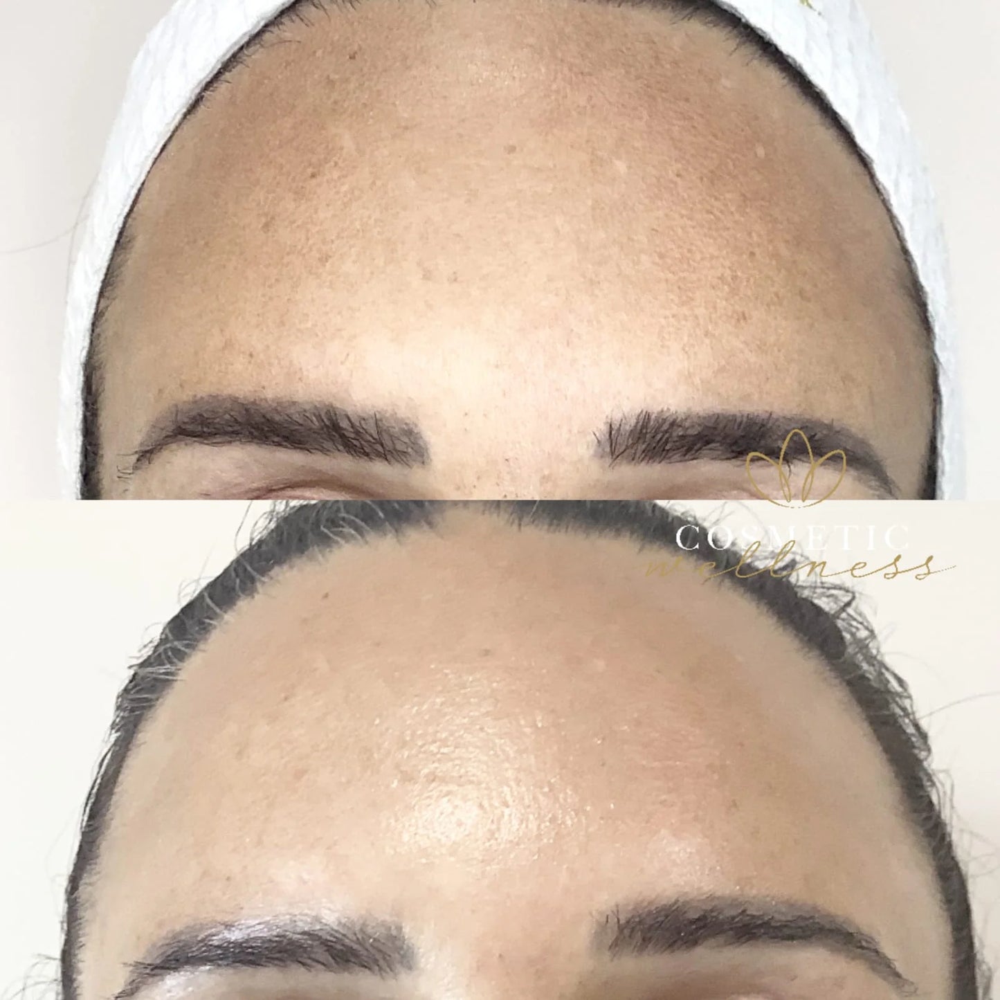 Pro Plasma